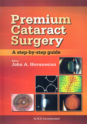 premium-cataract-surgery