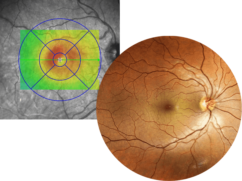 Scientific image of eye