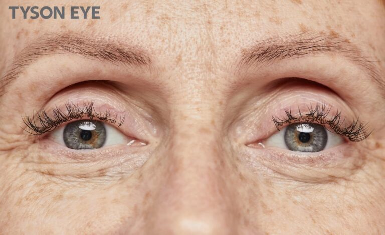 What are common changes to your eyes as you age photo of eyes