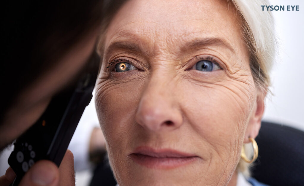 What is Glaucoma and How Is It Treated? Woman getting an eye exam.